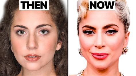 lady gaga surgery|Lady Gaga Plastic Surgery